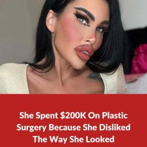 Plastic surgery addict spends $200K on plastic surgery